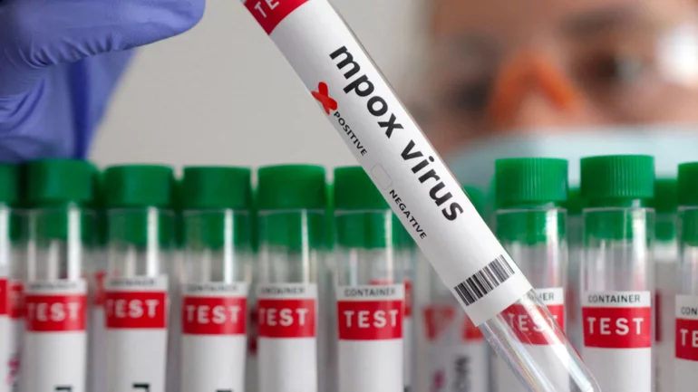 Morocco reports first Mpox case